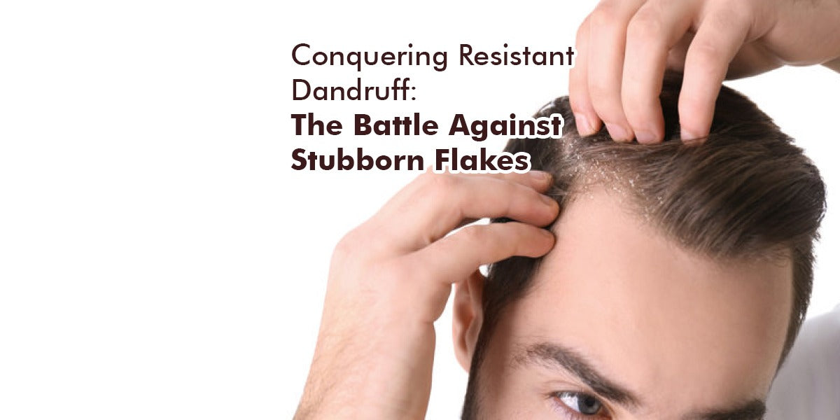 Why you need to choose an effective anti- dandruff shampoo ?