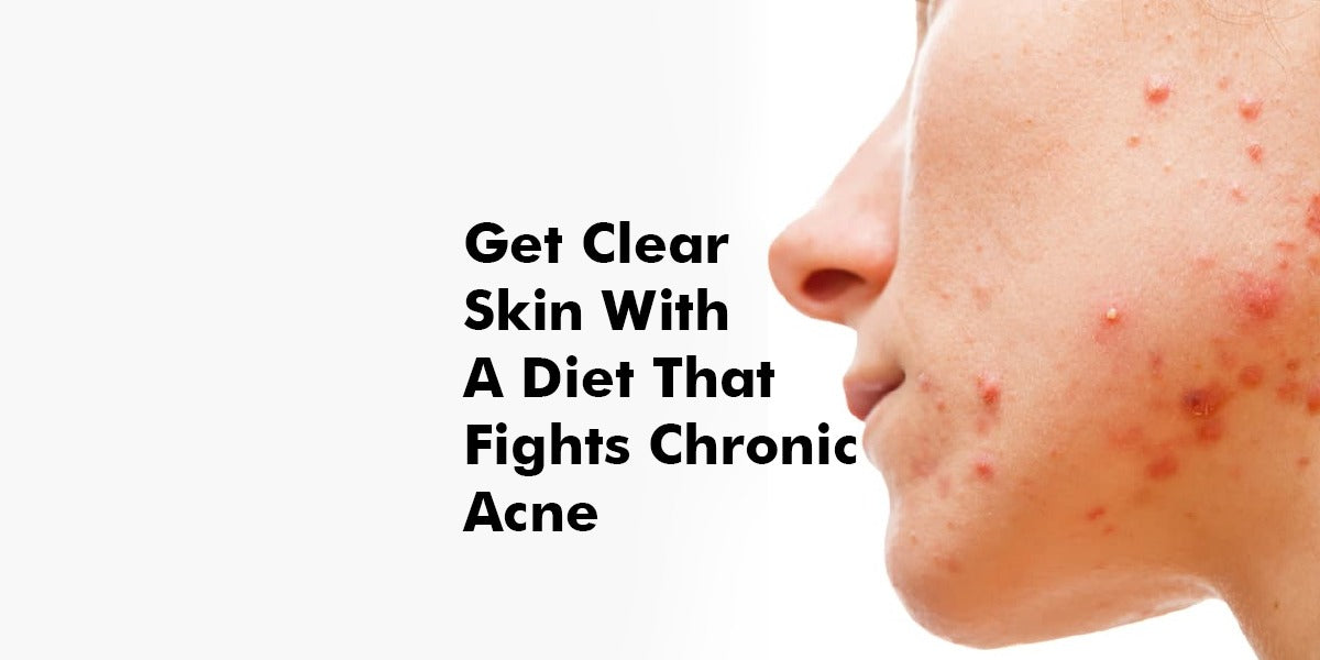 Unlock Clear Skin: Your Guide to a Diet that Fights Chronic Acne