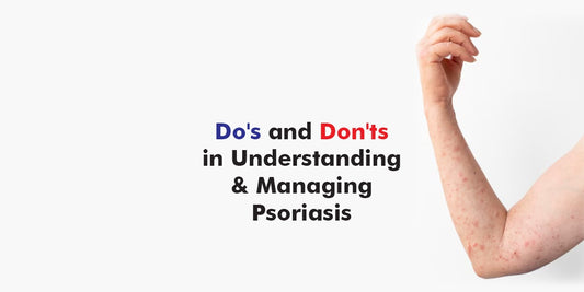 Do's and Don'ts in Understanding and Managing Psoriasis