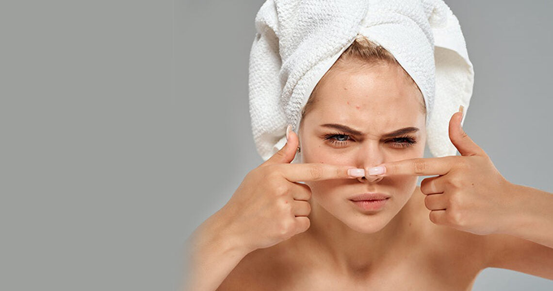 10 WAYS TO KEEP AWAY ACNE THIS SUMMER